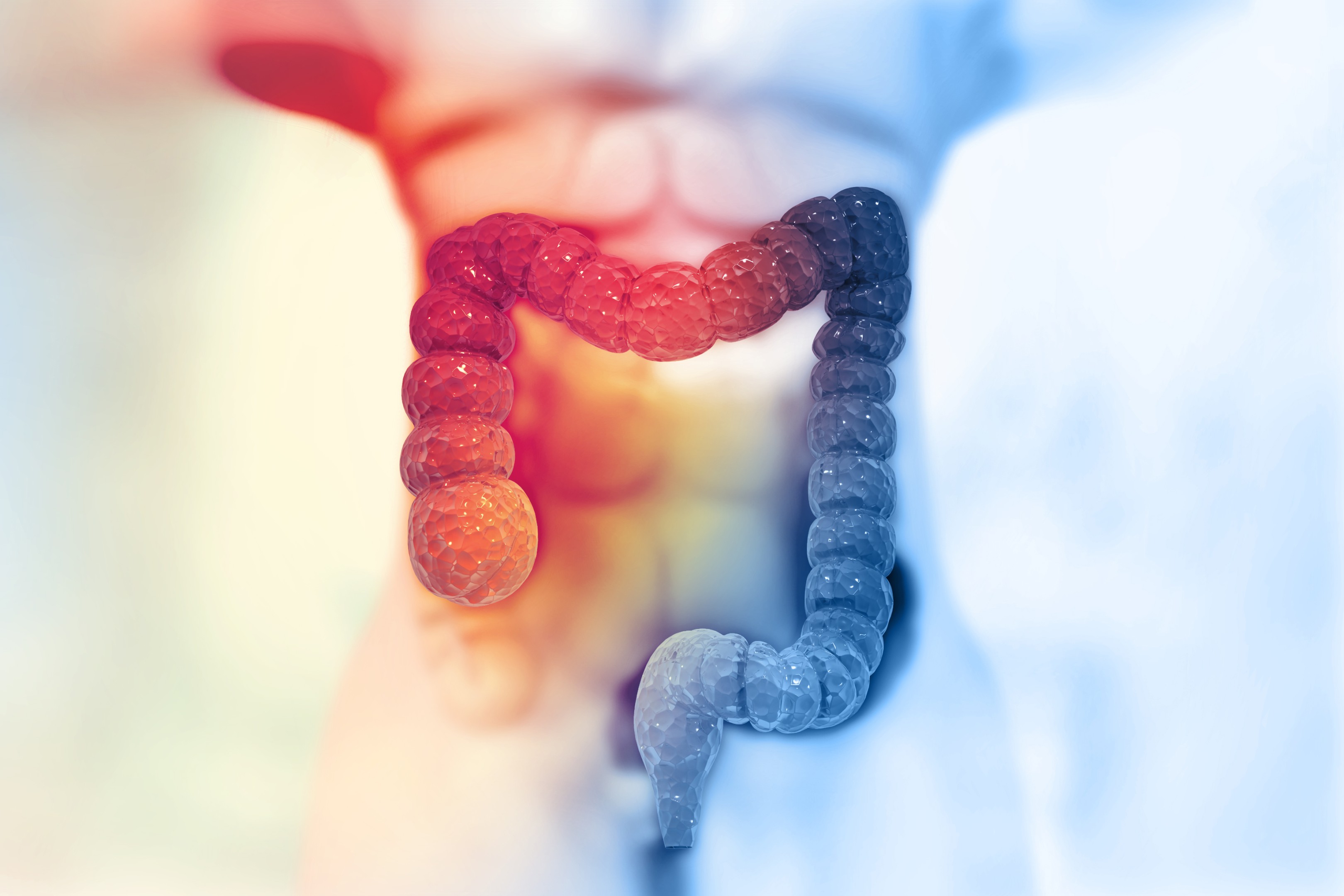 Chondroitin and Glucosamine for Colorectal Cancer Prevention?